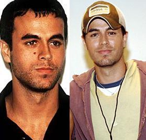 Cancerous Mole Removal Cancerous Mole Removal