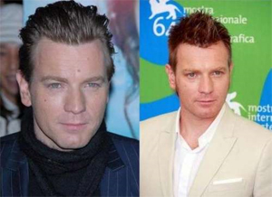 Facial Mole Removal Facial Mole Removal