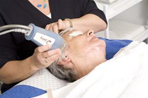 Laser Mole Removal Laser Mole Removal