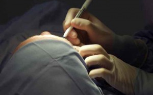 Mole Removal Clinics Mole Removal Clinics