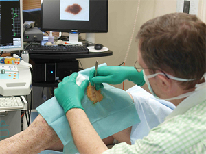 Mole Removal in Manchester Mole Removal in Manchester