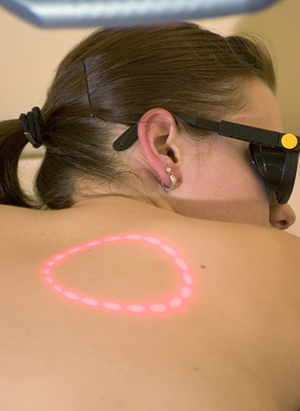 Mole Removal in Scotland Mole Removal in Scotland