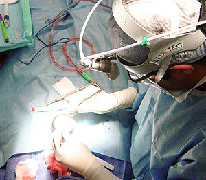 Mole Removal Plastic Surgeon Mole Removal Plastic Surgeon